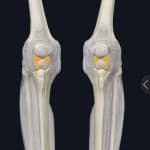 knee